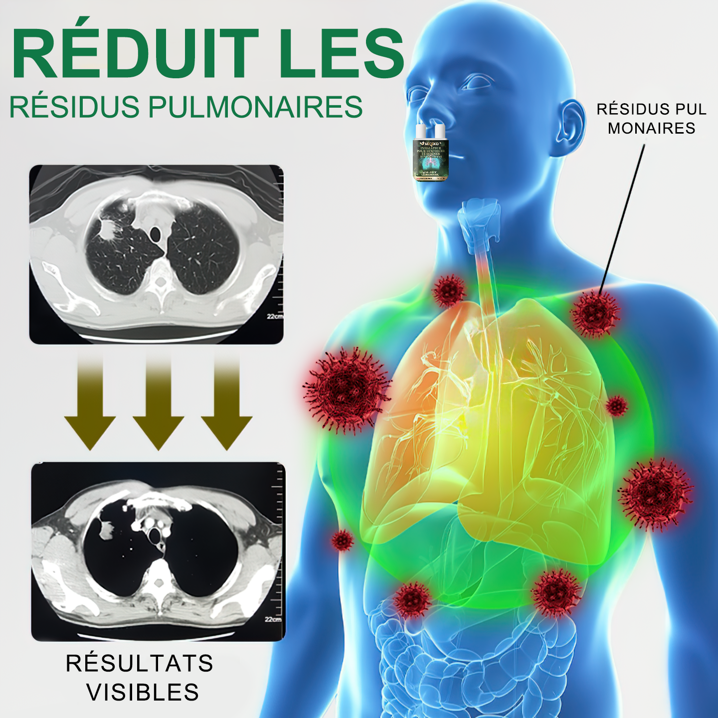 Il ne reste plus que 6 boîtes ! Nous offrons une réduction supplémentaire de 30% ! Recommandé par les pneumologues, 4 à 6 boîtes amélioreront votre maladie pulmonaire et préviendront les récidives !